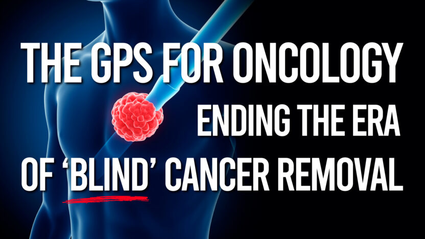 The GPS for Oncology: Ending the era of ‘blind’ cancer removal