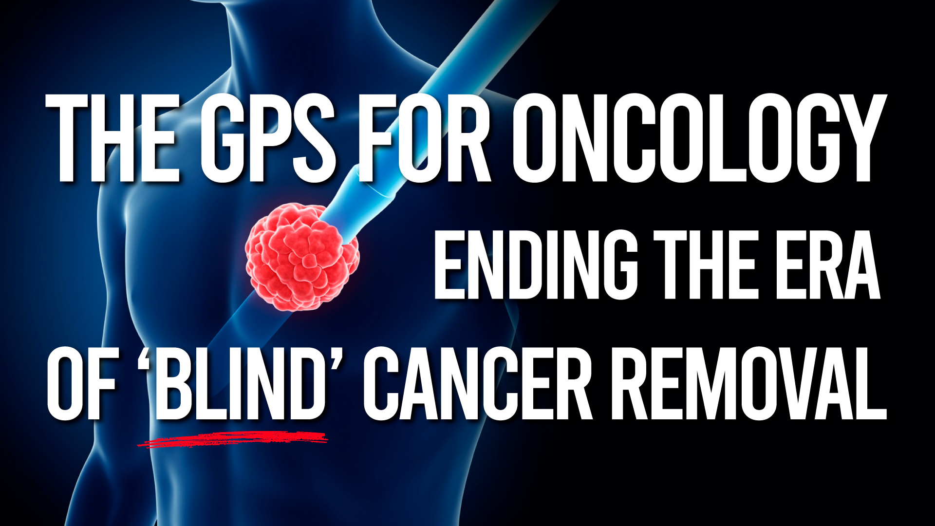 The GPS for Oncology: Ending the era of ‘blind’ cancer removal
